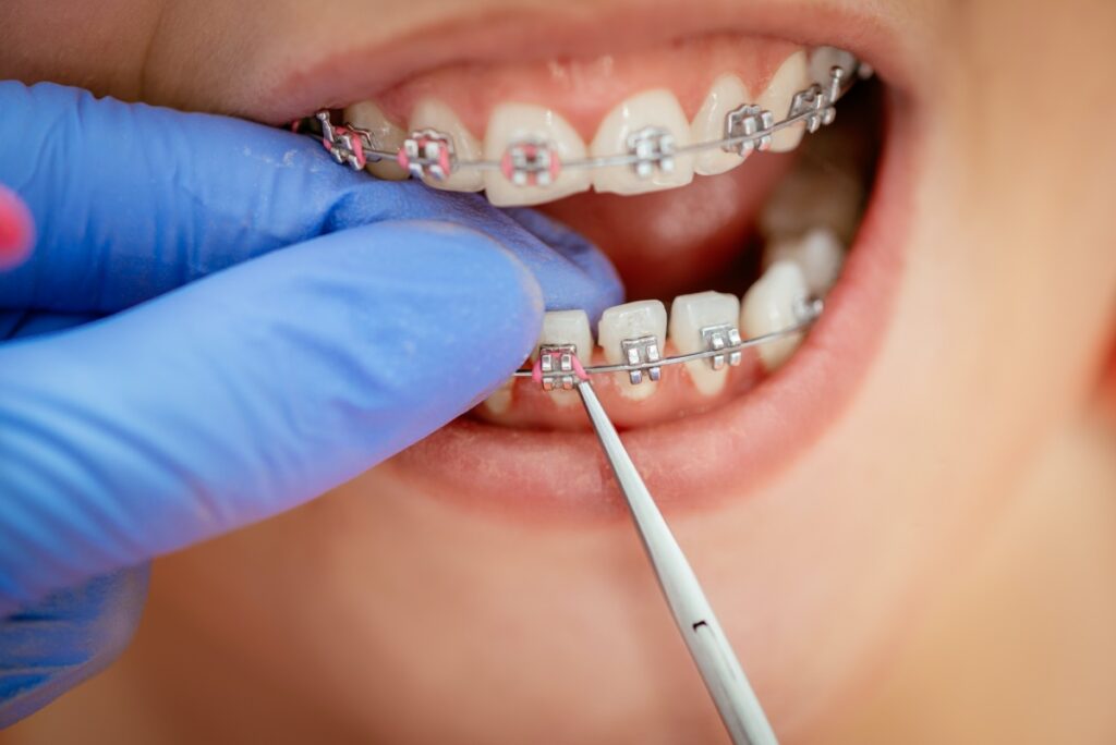 Rescue-Dent Profesjonalna asysta ortodontyczna